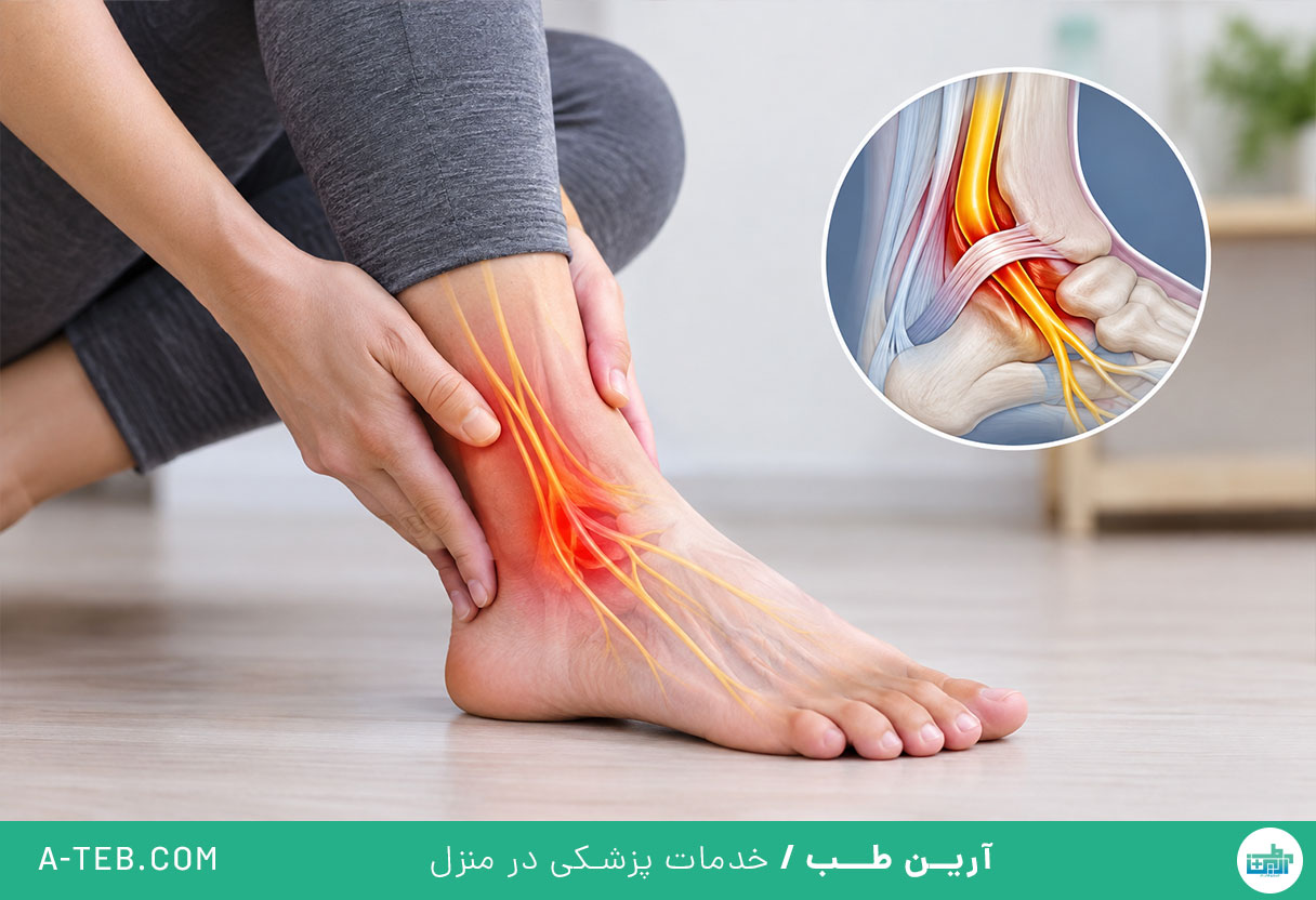 سندرم تونل تارسال