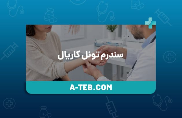 سندرم تونل کاریال