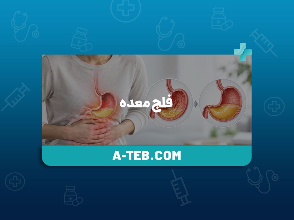 فلج معده