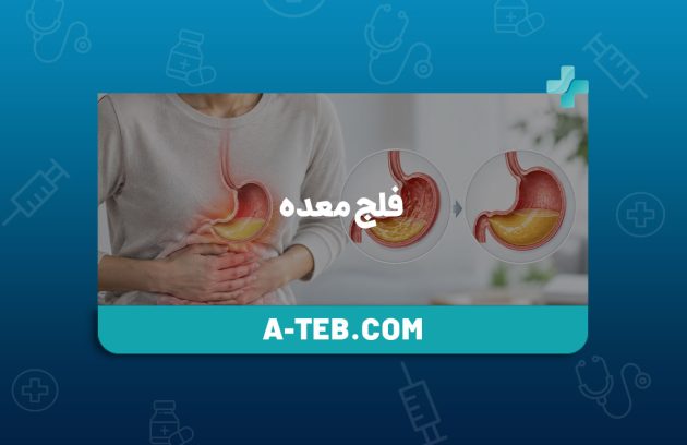فلج معده