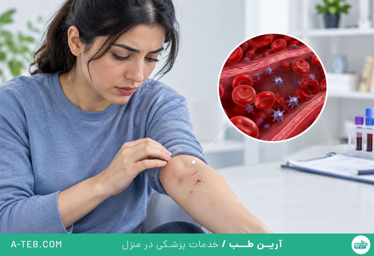 پلاکت خون پایین