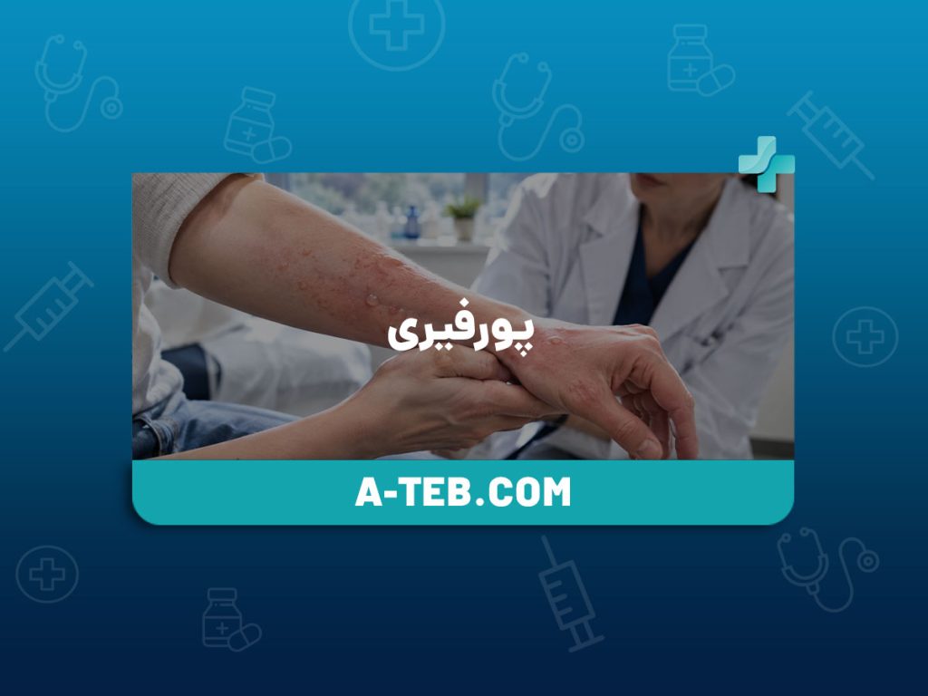 پورفیری